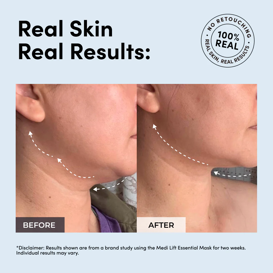 The Multi-Masking Bundle - Image 2