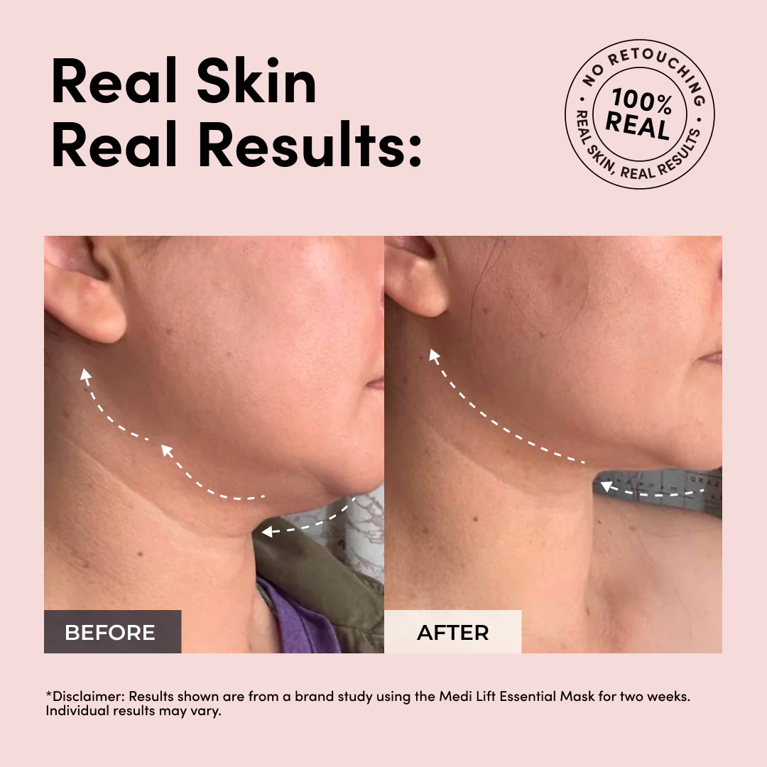 Luxe Lift Mask Set (White Pulse) - Image 3