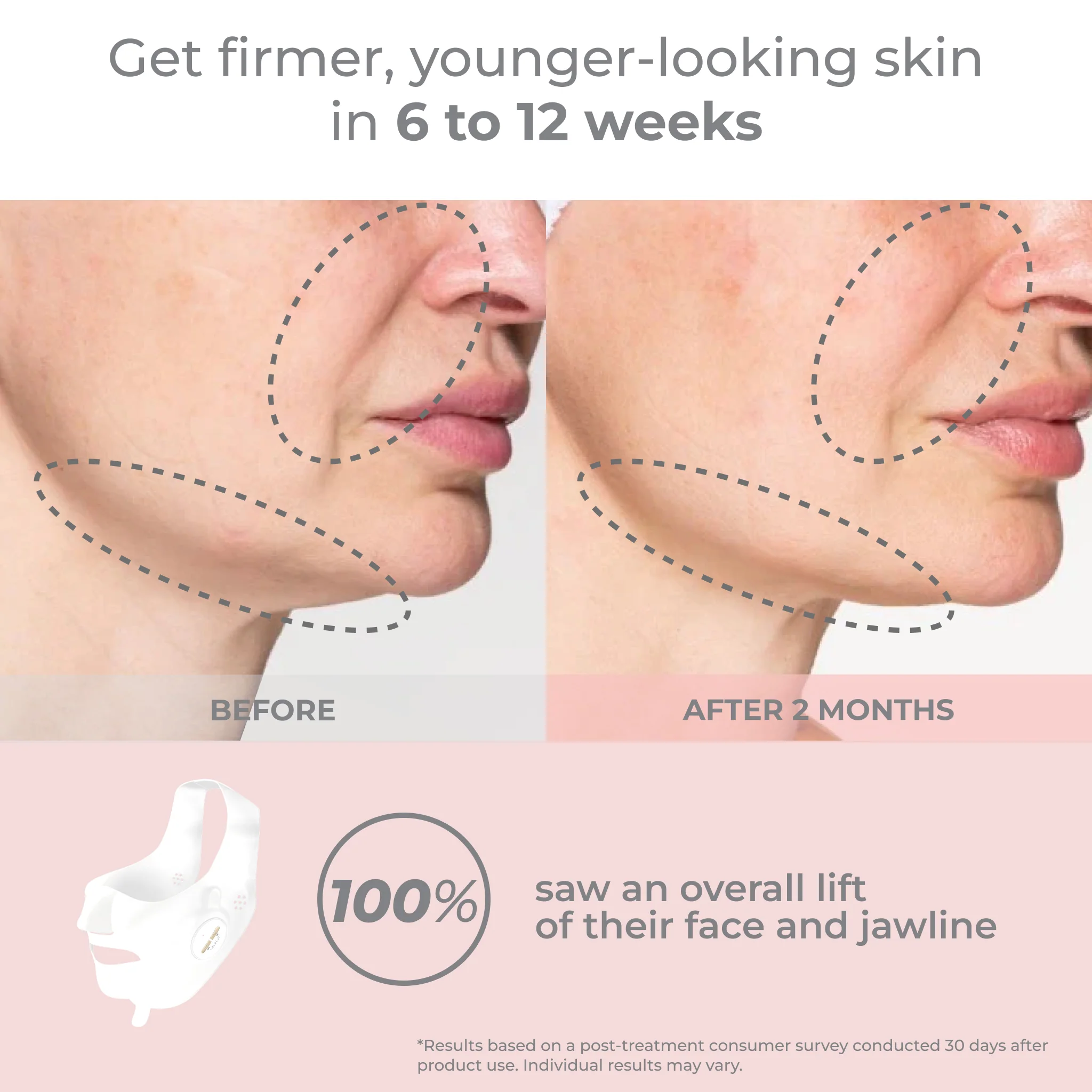 Luxe Lift Mask Set (White Pulse) - Image 4