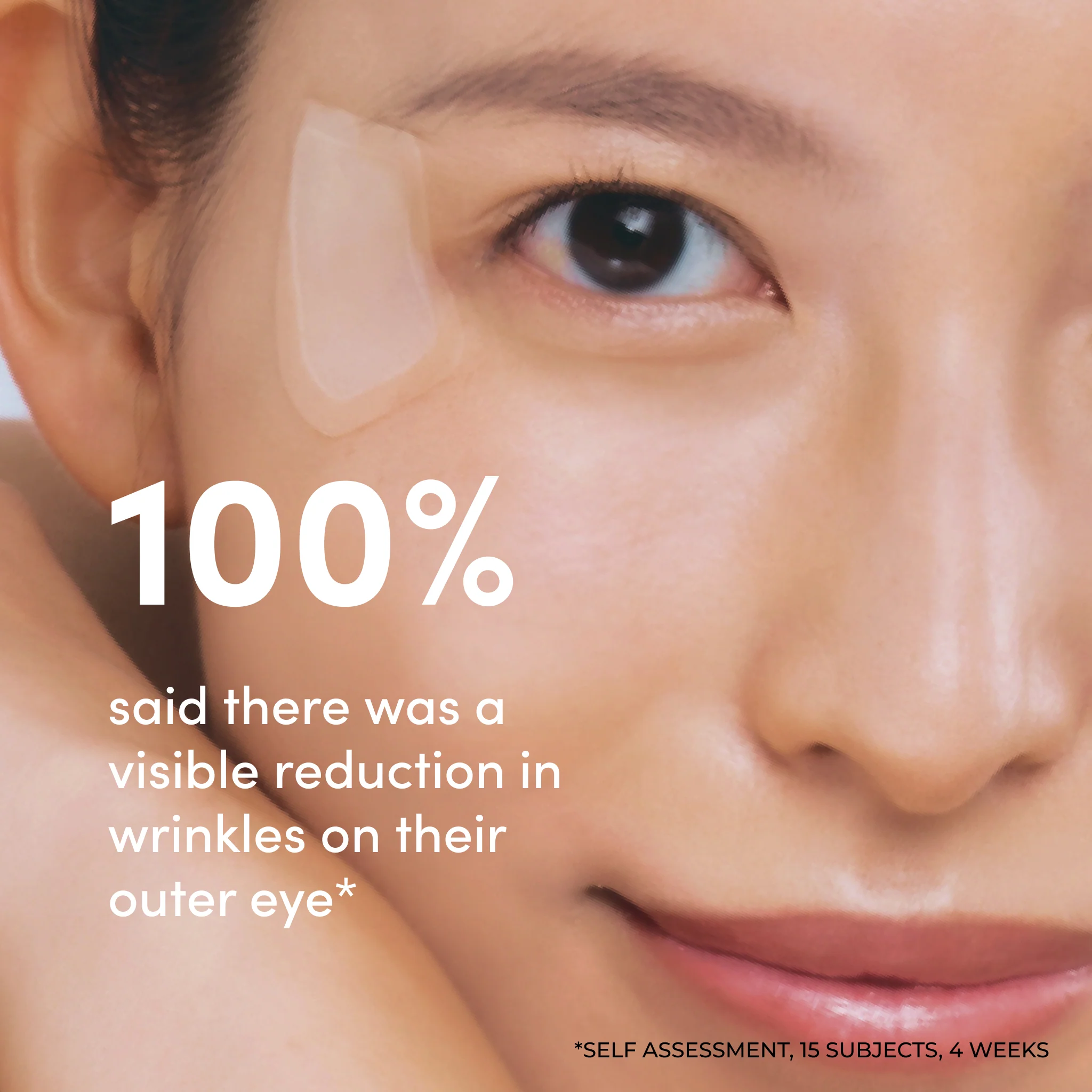 Microfiller Outer Eye | Micro-Tip Patches - Image 3