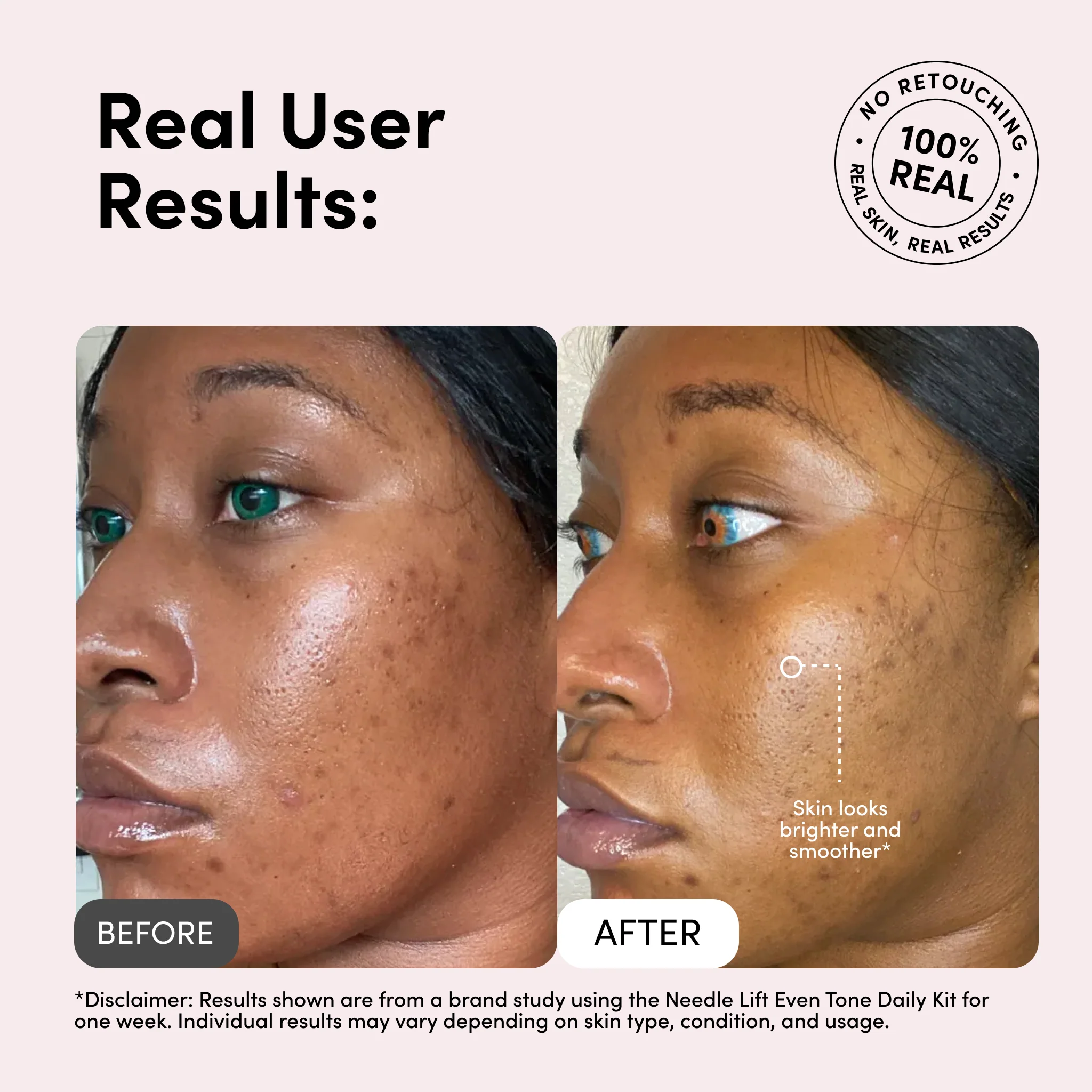 Needle Lift Cream Tone + - Image 4