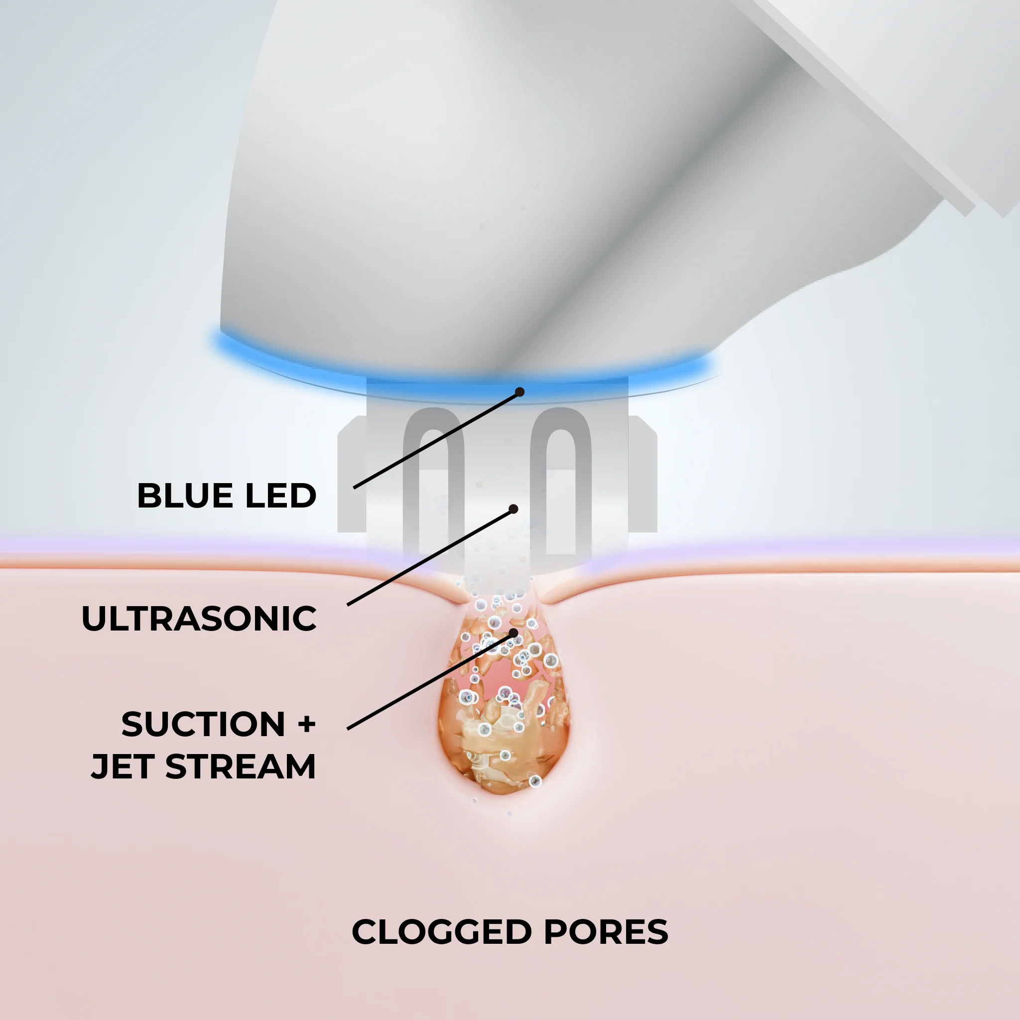 POREFICIENT™ Advanced Deep Pore Cleansing Device with Suction, Ultrasonic & Blue LED - Image 4